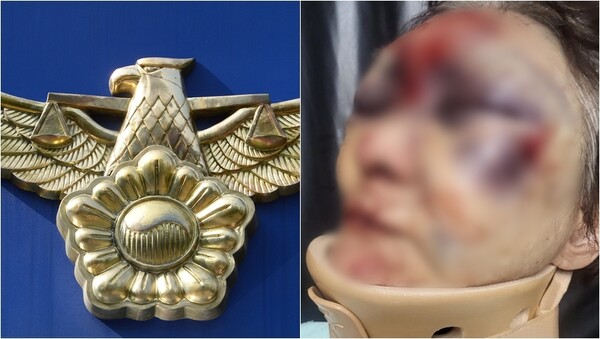 기사와 상관 없는 자료사진(왼), 80대 할머니가 실종 6시간 만에 폭행당한 채 발견된 모습(오).&nbsp;ⓒ뉴스1, 온라인 커뮤니티 보배드림&nbsp;