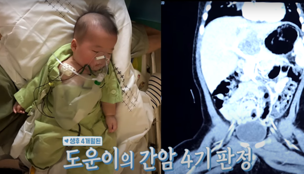 4개월 아기가.. ⓒKBS