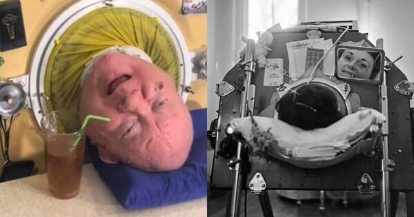 한평생 철제 산소통에서 지내며 '아이언렁맨(iron lung man)으로 알려진 미국의 변호사 겸 작가 폴 알렉산더가 78세 일기로 세상을 떠났다. ⓒ폴 알렉산더 틱톡, GettyImages Korea
