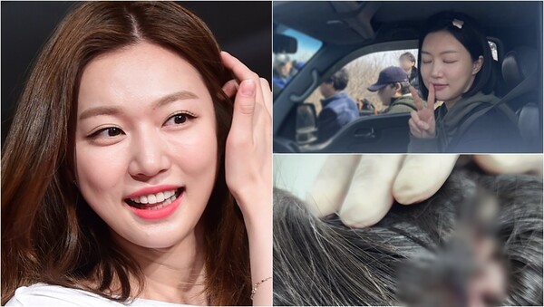 배우 하연주(왼), 드라마 촬영 도중 부상을 입은 모습(오).&nbsp;ⓒ뉴스1, 하연주 인스타그램&nbsp;