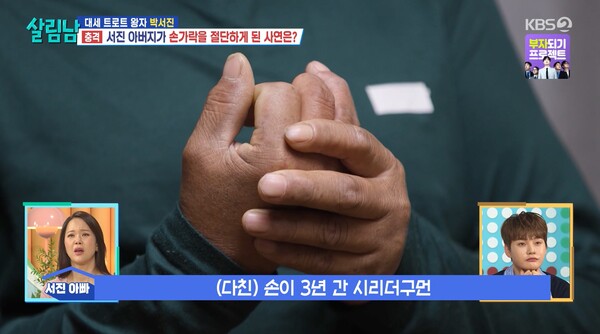 아버지는 다친 손이 3년간 시렸다. ⓒKBS 2TV ‘살림하는 남자들 시즌2’