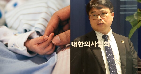 기사와 관련 없는 아기 손 사진(좌), 임현택 대한의사협회 회장(우) ©픽사베이/뉴스1&nbsp;&nbsp;