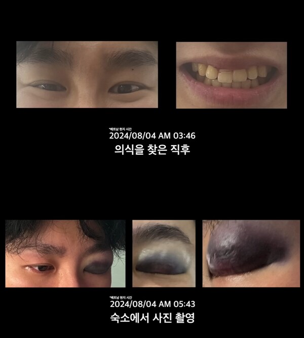 의식을 되찾은 이후 상태 ⓒ강대불