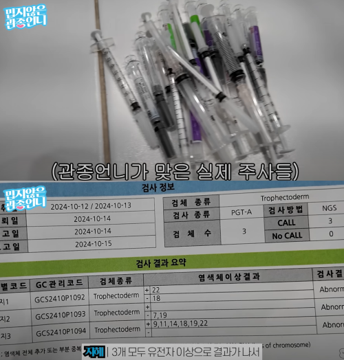 시험관 시술 실패한 이지혜. ⓒ유튜브 '밉지않은 관종언니'
