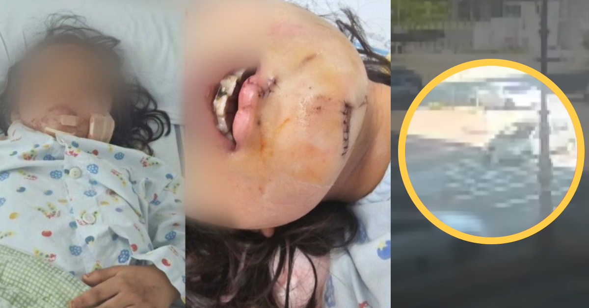 80대 무면허 운전자에 의해 사고를 당한 피해 아동과 사고 당시. ⓒMBC ‘실화탐사대’ / JTBC ‘사건반장’