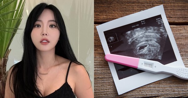 홍진영(좌), 사진자료(우). ⓒSNS, 어도비스톡