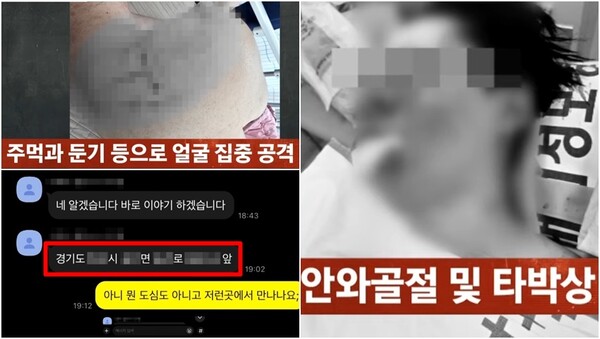 심각한 부상을 당한 유튜버 수탉의 현재 상황. ⓒJTBC ‘사건반장’