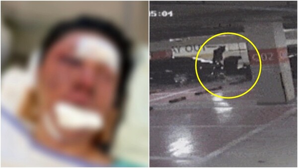 유튜버 수탉 입원 당시의 모습과 폐쇄회로(CC)TV 영상. ⓒ숲 라이브 방송 캡처,&nbsp;인천지검 제공