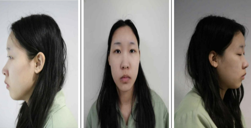 ‘강북 모텔 연쇄살인 사건’ 피의자 김소영의 신상 정보 공개됐다 : 사이코패스 검사 결과는 기준치 이상