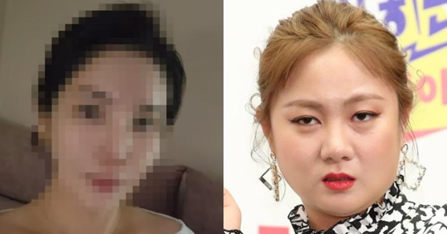 삶을 끝내려 했다..., 불법시술 의혹 주사이모 A씨가 자신의 얼굴을 공개하며 심경을 고백했다